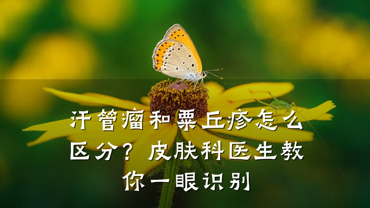 汗管瘤和粟丘疹怎么区分?皮肤科医生教你一眼识别
